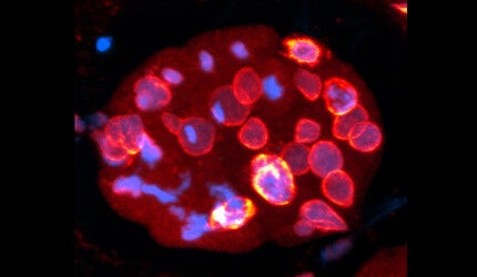 The nuclear envelope (orange) protects DNA (blue) in this image of a worm embryo.