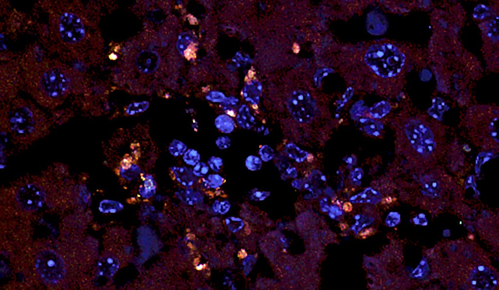 A microscopic photo of the gut bacterium E. gallinarum in liver tissue