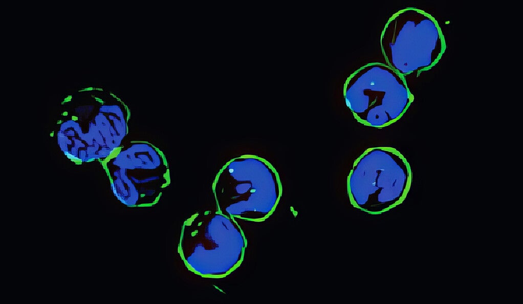 Images of RNA on neutrophil cell surface.