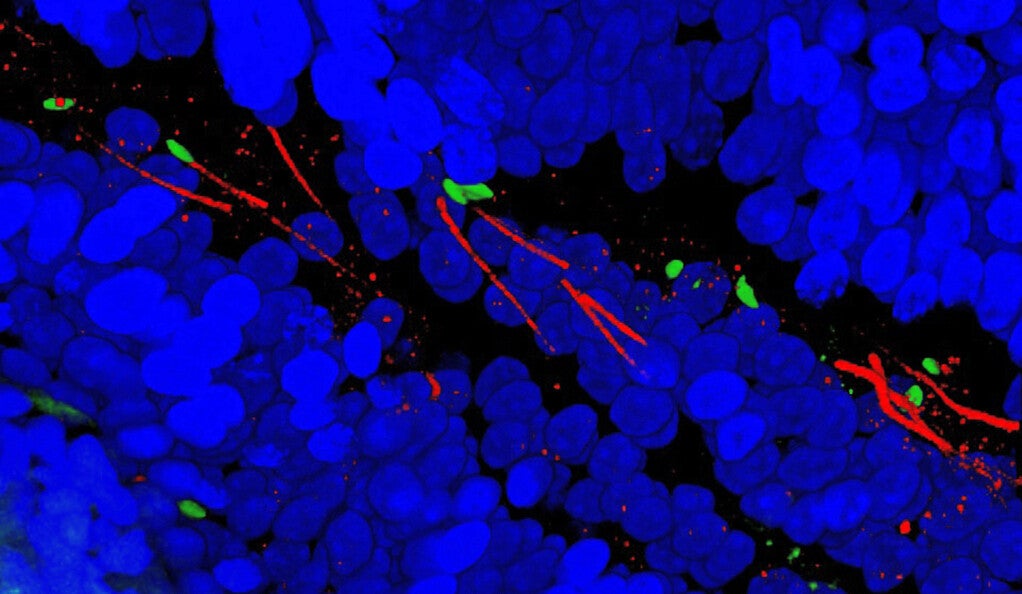 Yale researchers track sperm (highlighted red) in mouse reproductive track.