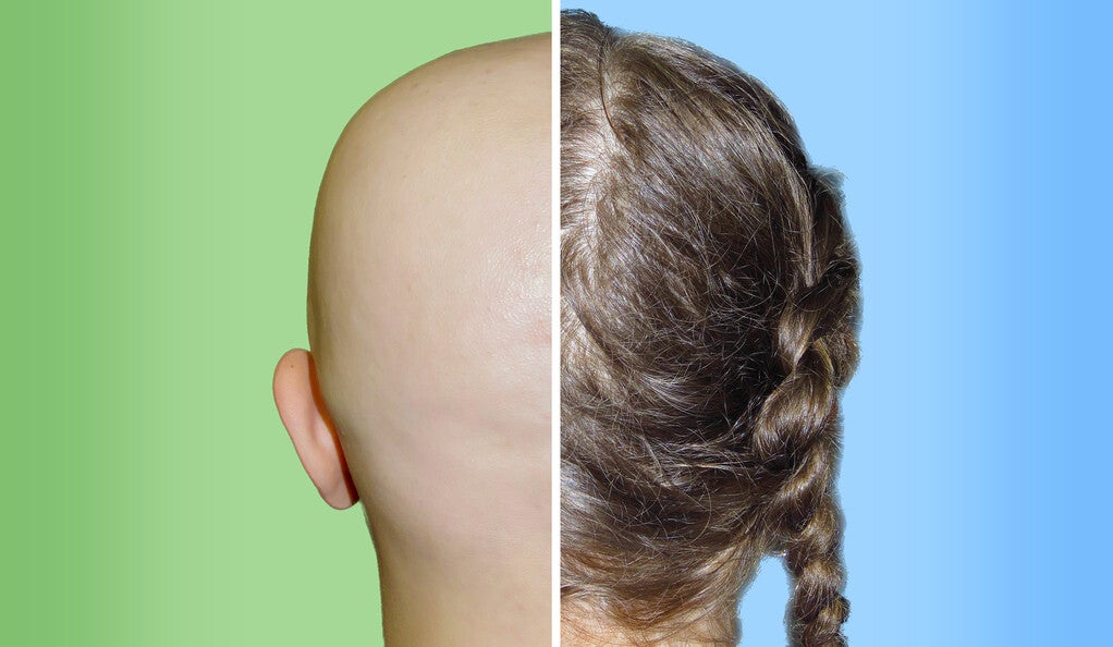 A side by side comparison of the same patient before and after treatment.