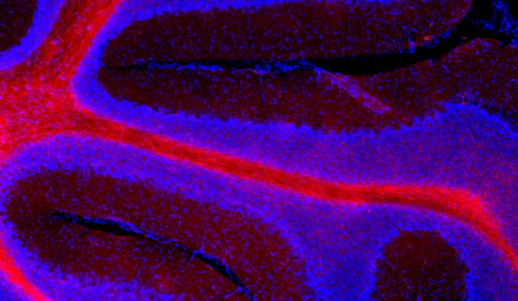 The cortex of the cerebellum, with granule cell neurons (stained blue) and myelinating cells (stained red)