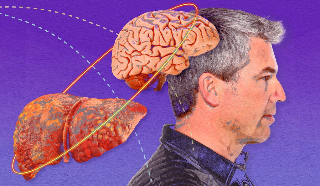An illustration of a man, a brain, and a liver and how they are connected. 