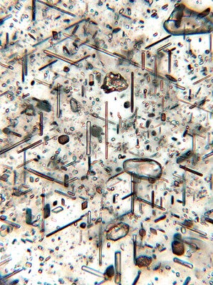 A photomicrograph of a thin section of a rock sample