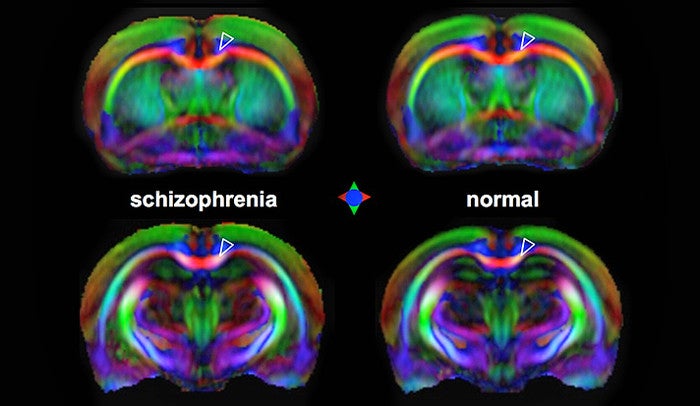 Anatomical scan, as measured by an MRI technique sensitive to water diffusion in a preclinical rodent model of schizophrenia.