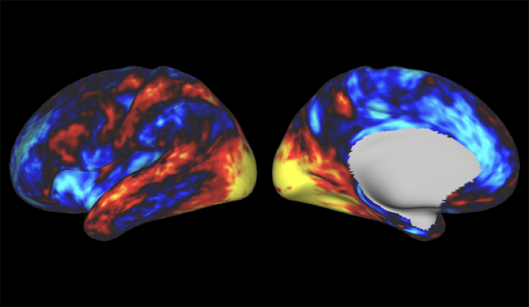 Brain scans showing increased communication between areas involved in sensation and movement after taking LSD.
