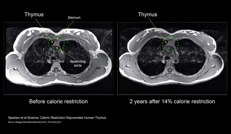Comparison of thymus before and after calorie restriction.