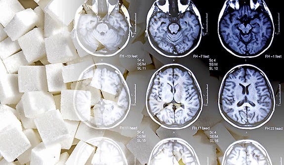 A collage combining a photo of sugar cubes with medical brain scans